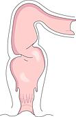 Rectum Illustrations and Clip Art. 617 rectum royalty free ...
 Rectum Drawing