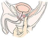 剪贴画 - 形象, 显示, 男性, 骨盆部, area., 二, 手